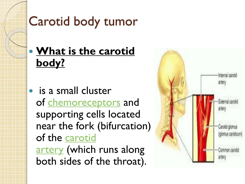 carotid body tumor