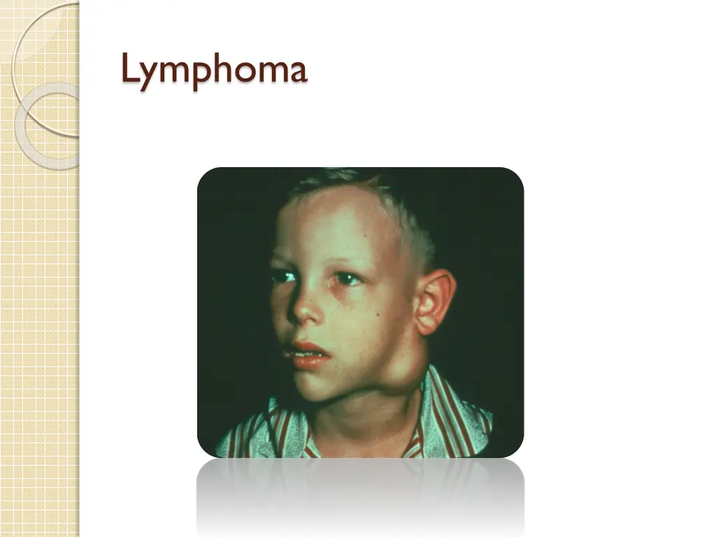 lymphoma