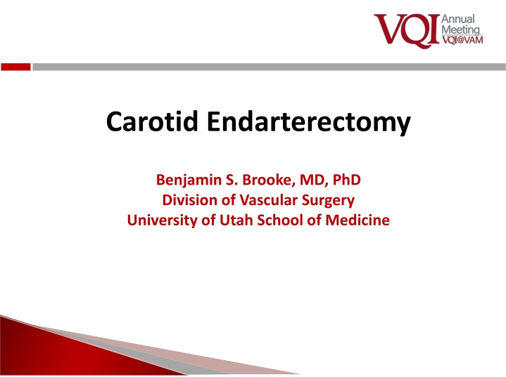 carotid endarterectomy