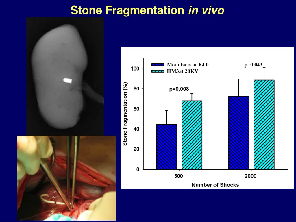 stone fragmentation in vivo