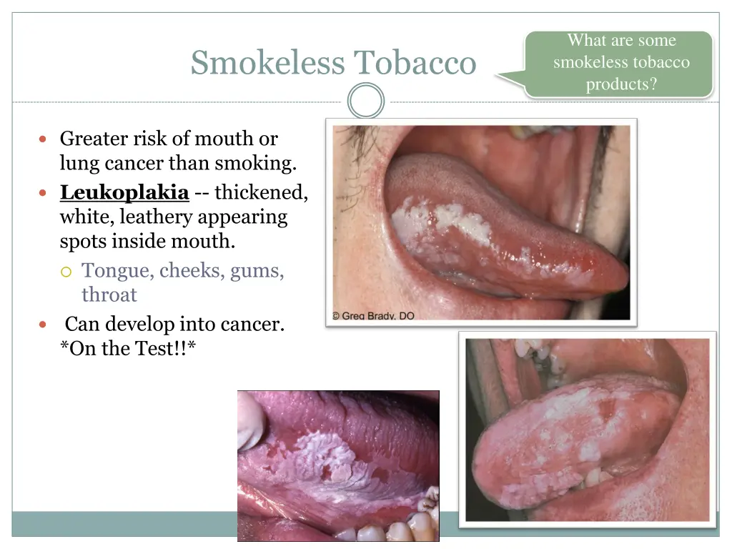 what are some smokeless tobacco products