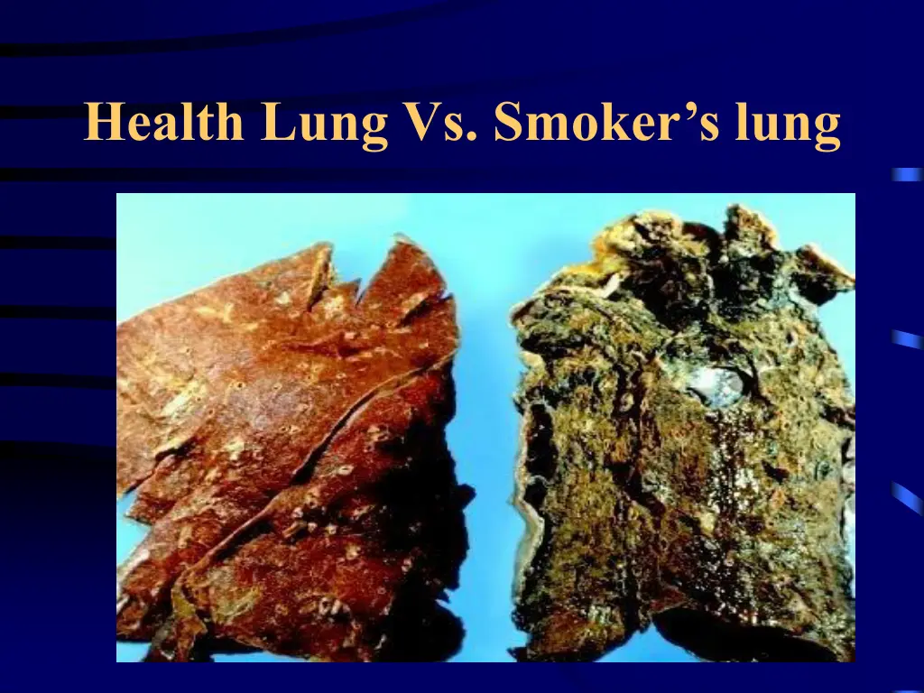 health lung vs smoker s lung