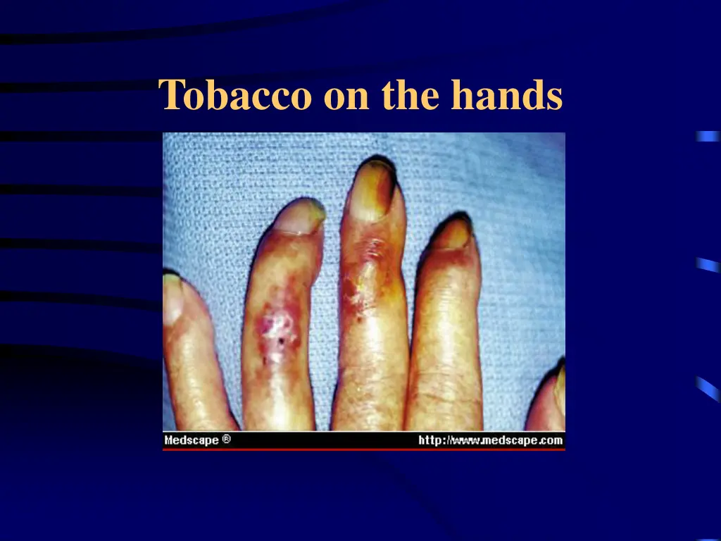 tobacco on the hands