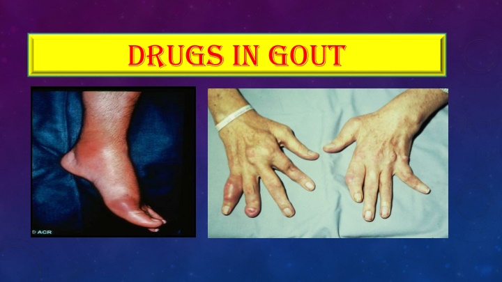 drugs in gout