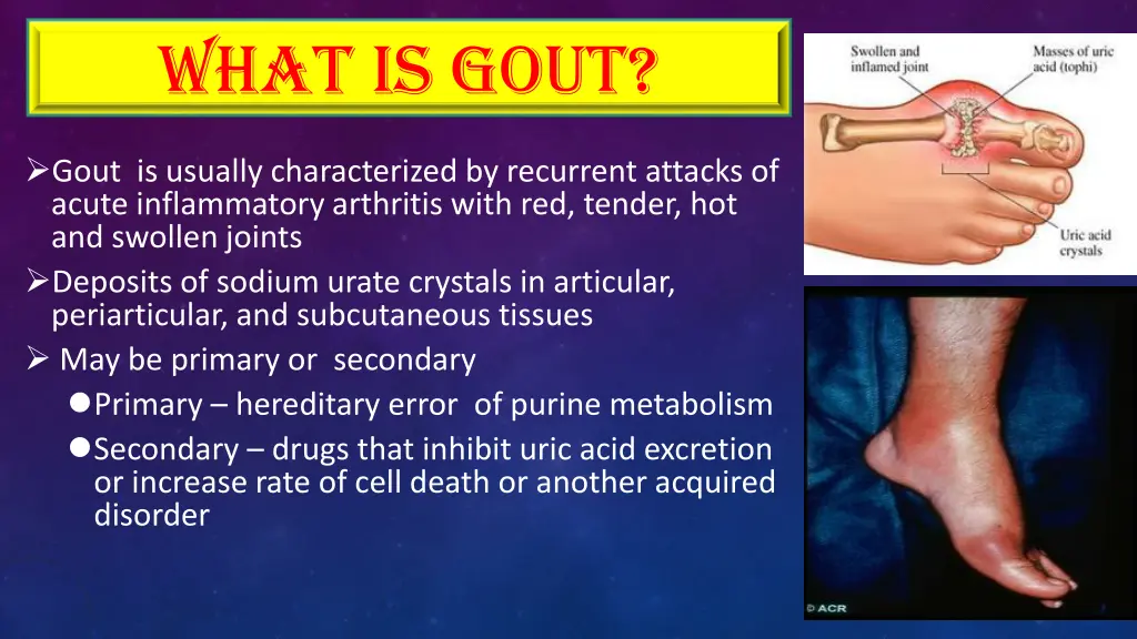 what is gout