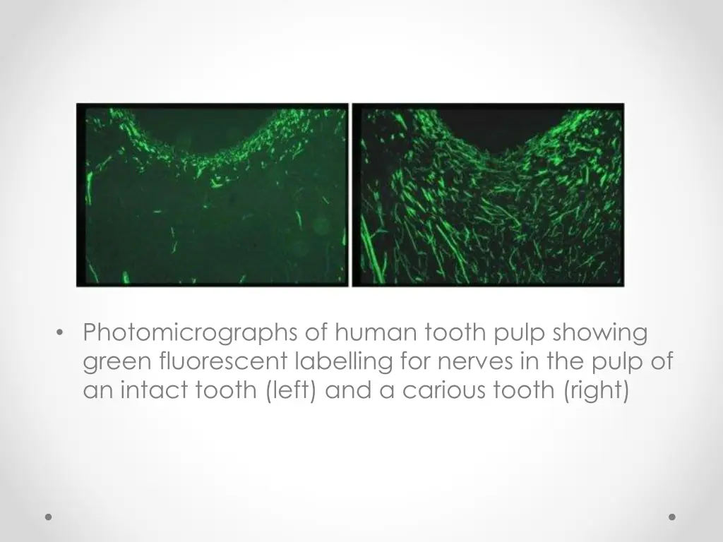 photomicrographs of human tooth pulp showing