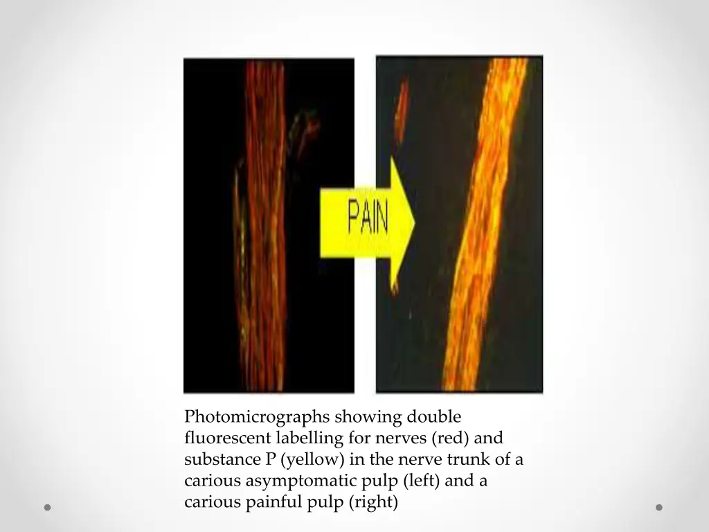 photomicrographs showing double fluorescent