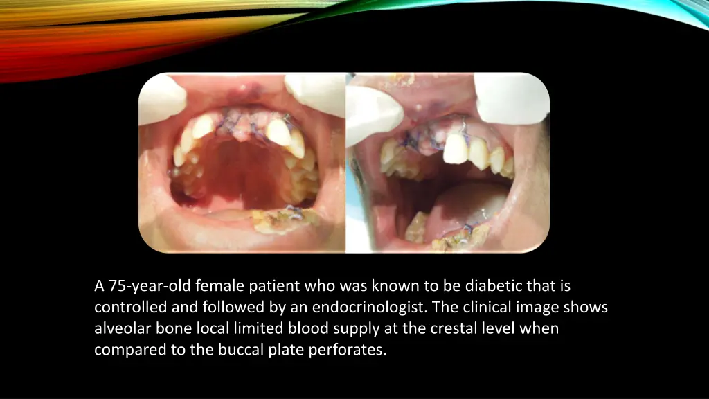 a 75 year old female patient who was known