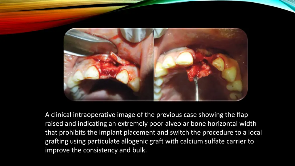 a clinical intraoperative image of the previous