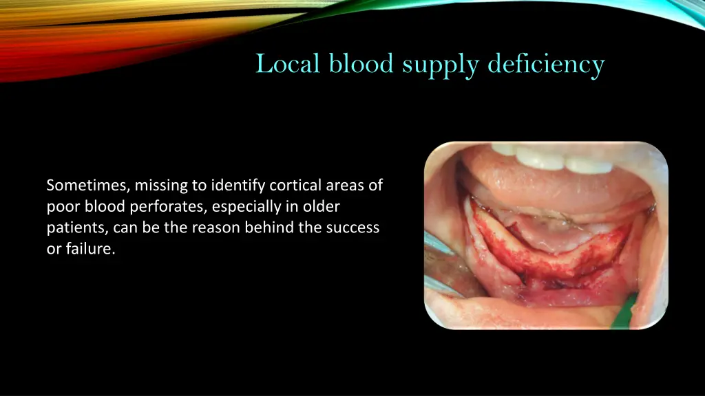 local blood supply deficiency