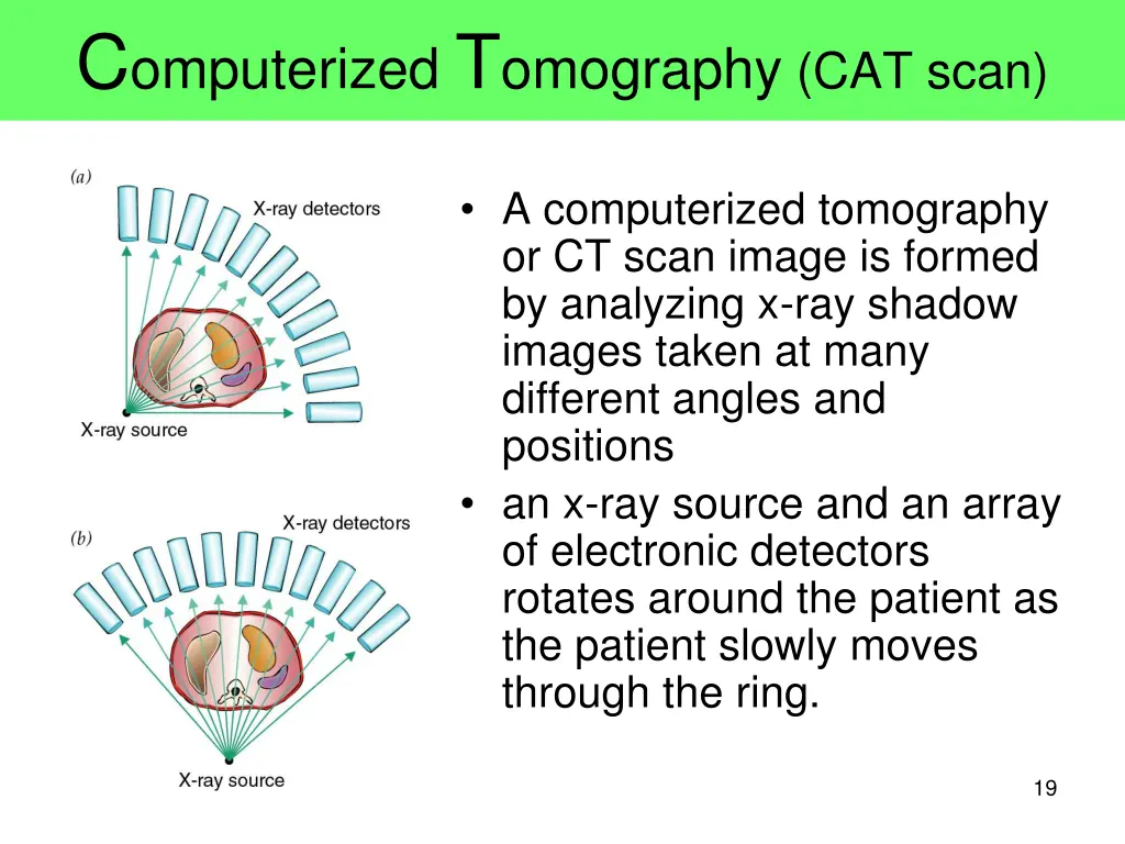 c omputerized t omography cat scan