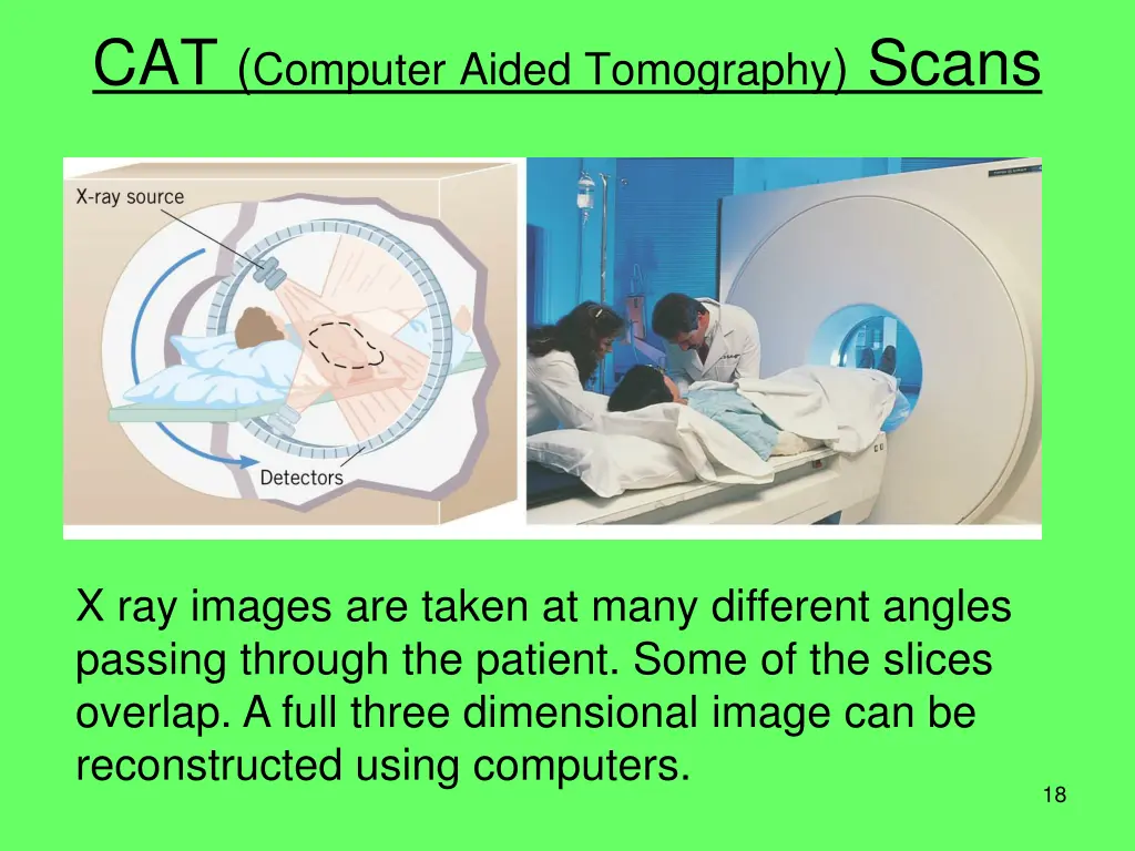 cat computer aided tomography scans