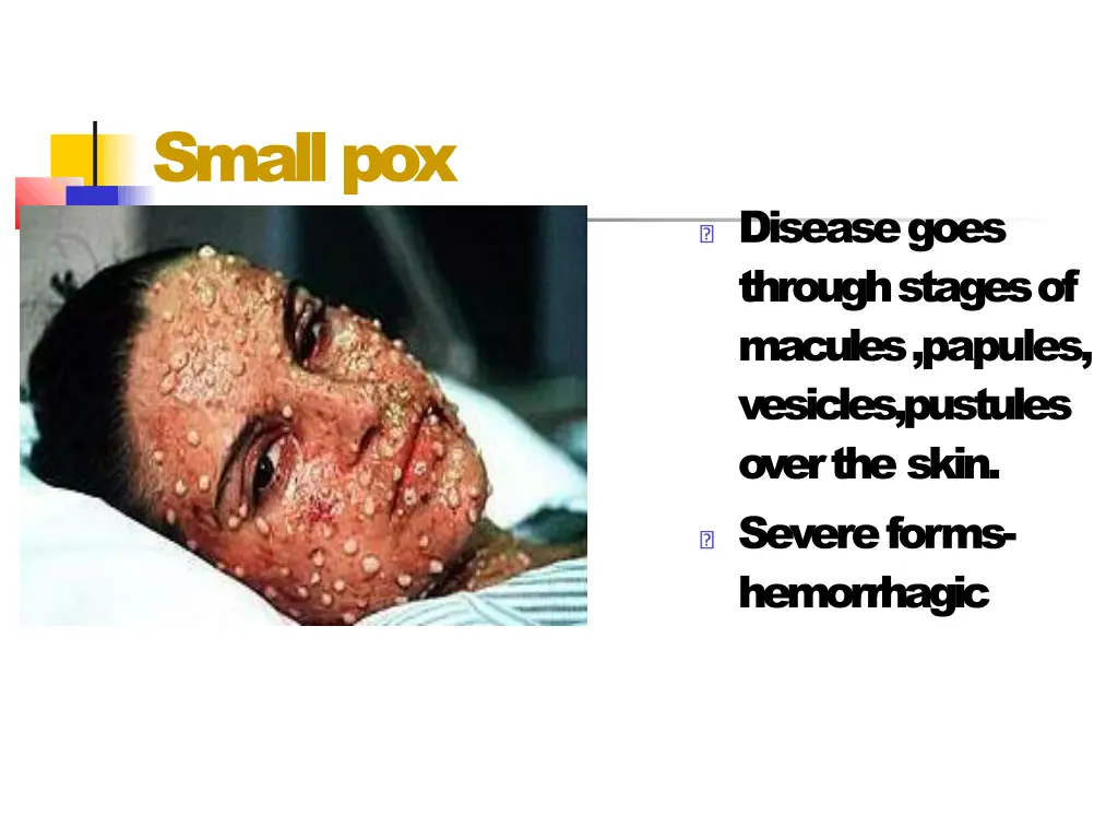 smallpox