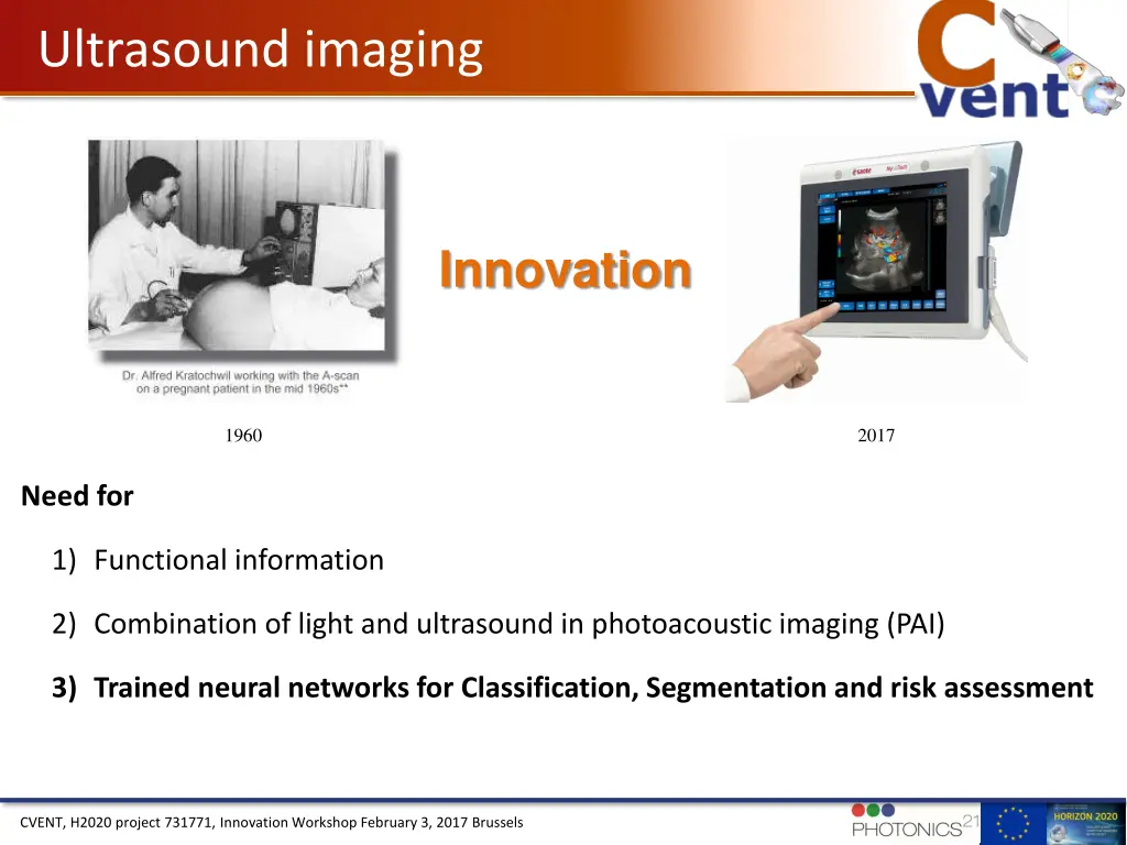 ultrasound imaging