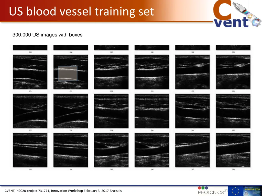 us blood vessel training set