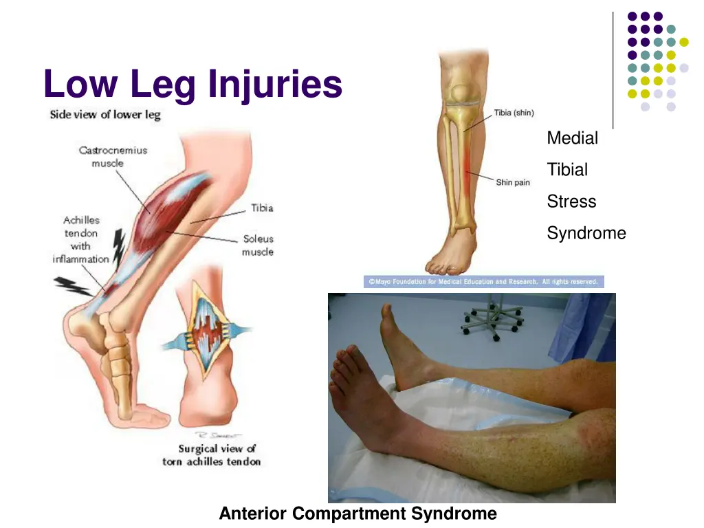 low leg injuries 1