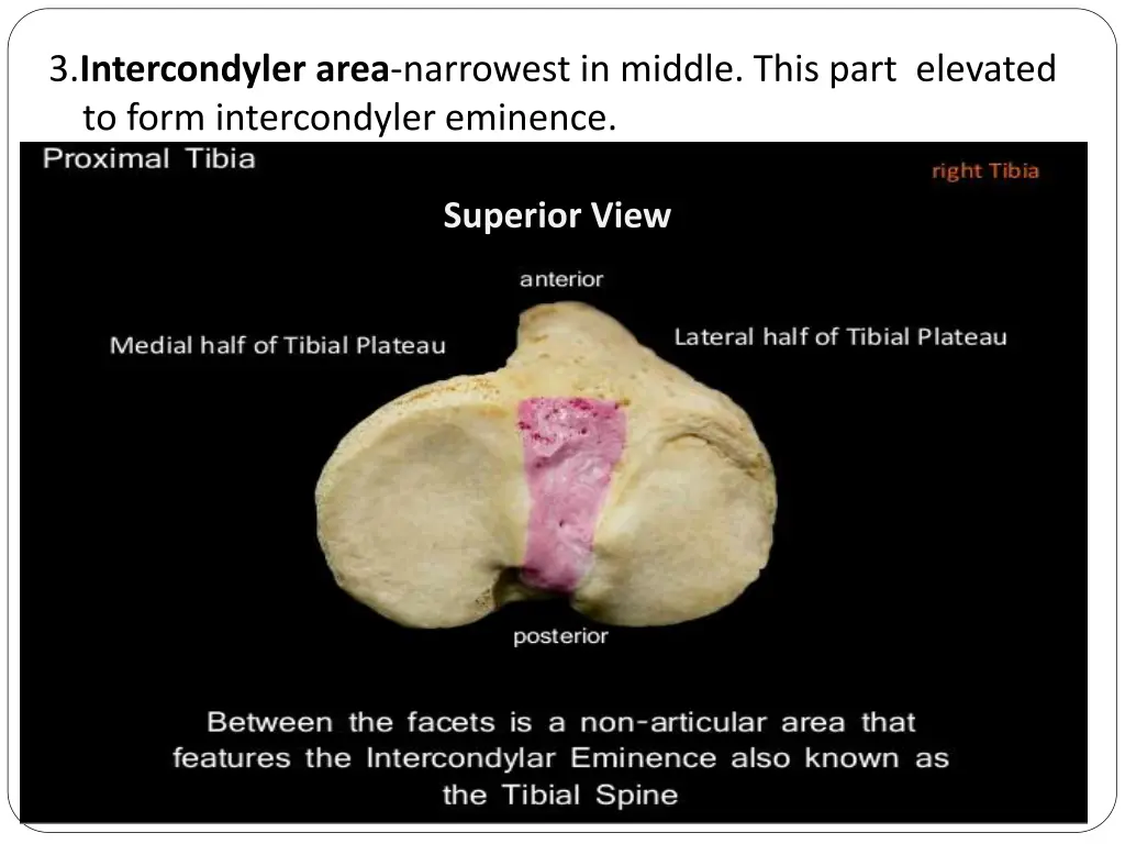 3 intercondyler area narrowest in middle this