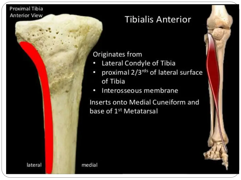 slide18