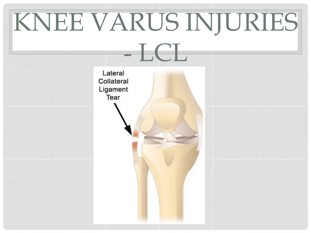 knee varus injuries lcl