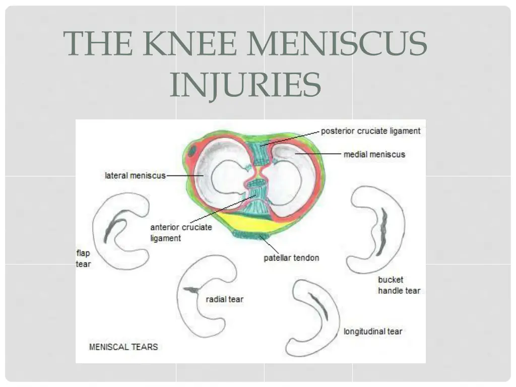 the knee meniscus injuries