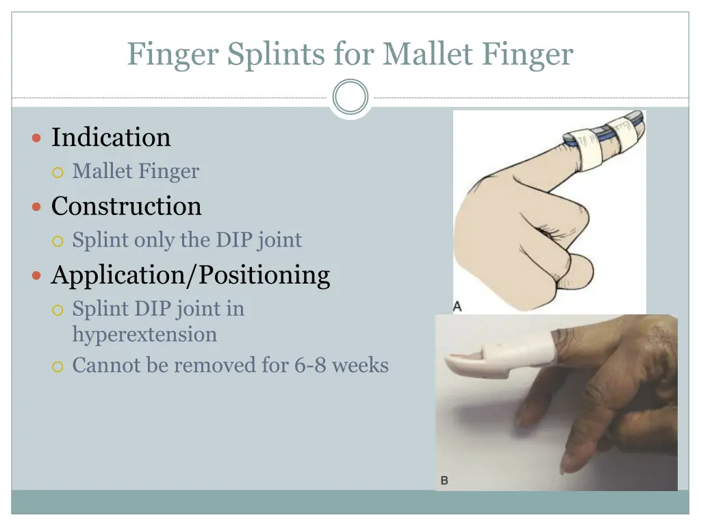 finger splints for mallet finger