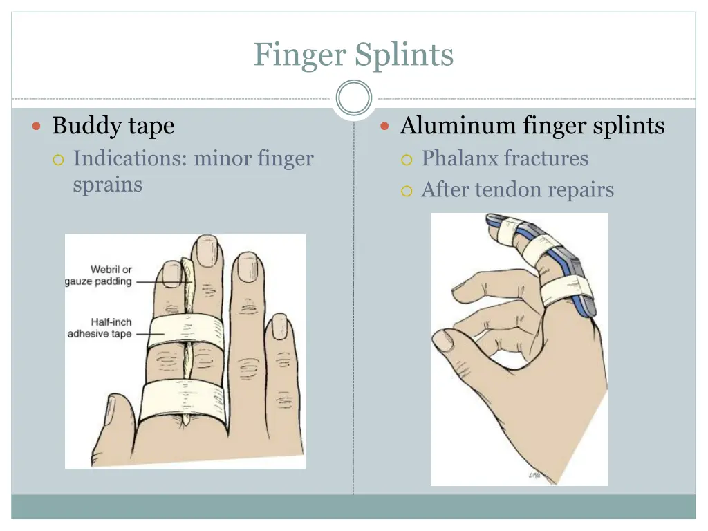 finger splints