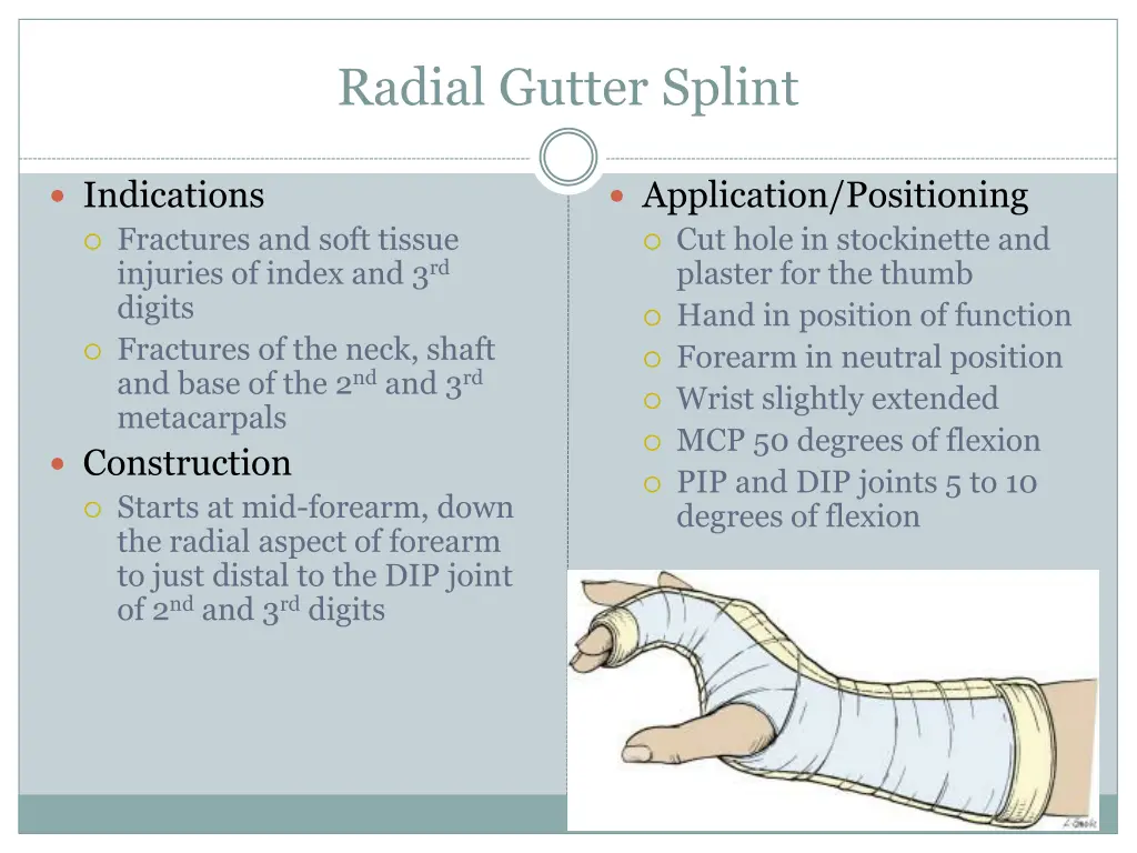 radial gutter splint