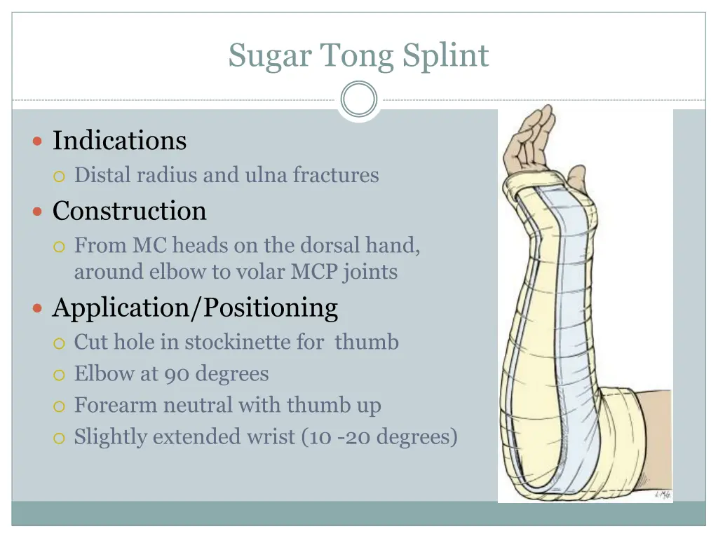 sugar tong splint