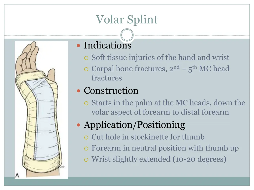 volar splint