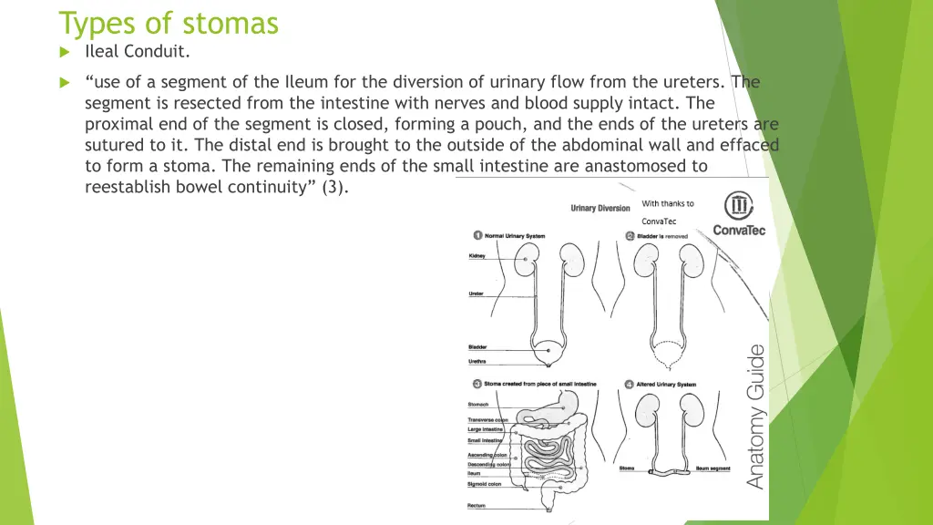 types of stomas ileal conduit