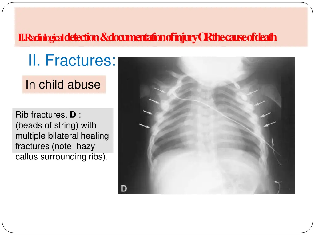 a radiology of injury ii fractures 1