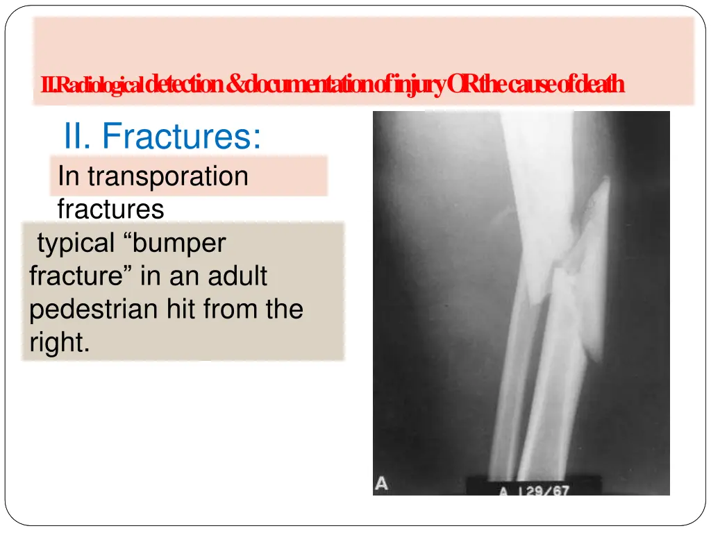 a radiology of injury ii fractures 2