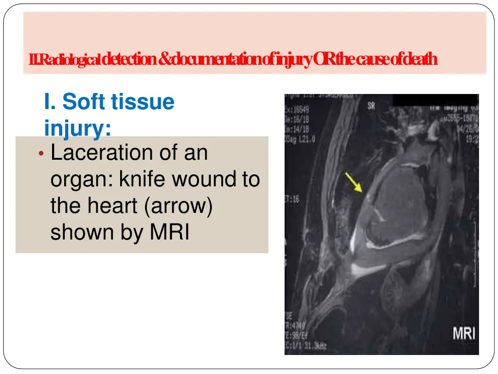 a radiology of injury ii radiological detection 1