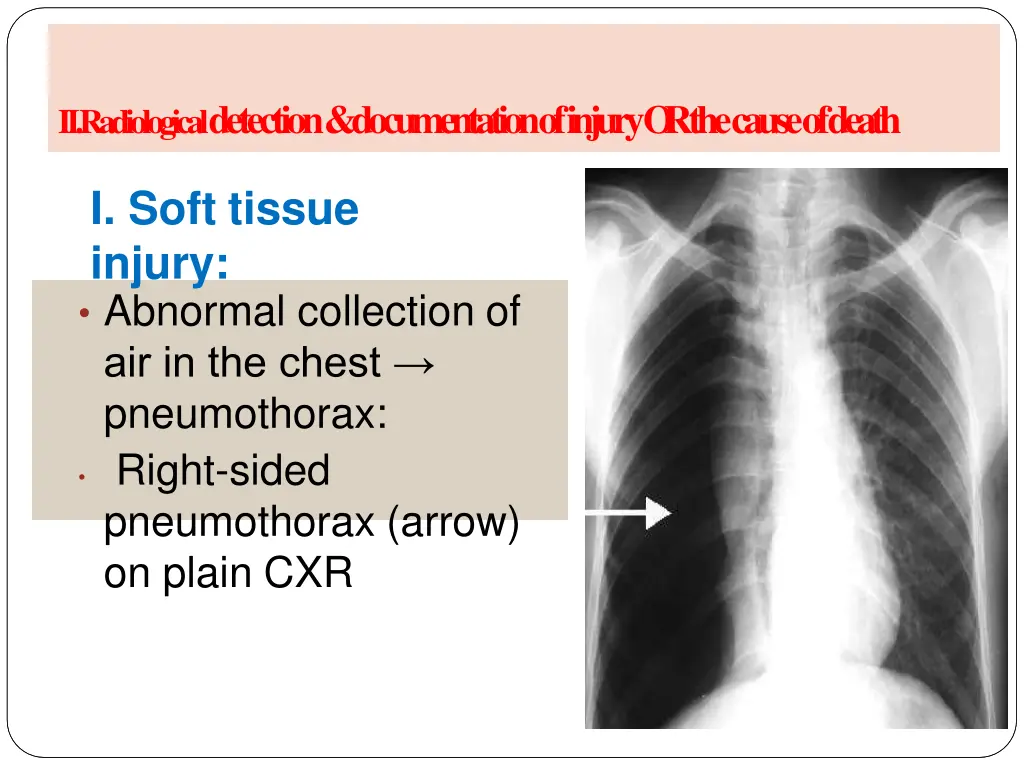 a radiology of injury ii radiological detection 2