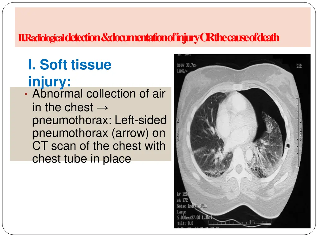 a radiology of injury ii radiological detection 3