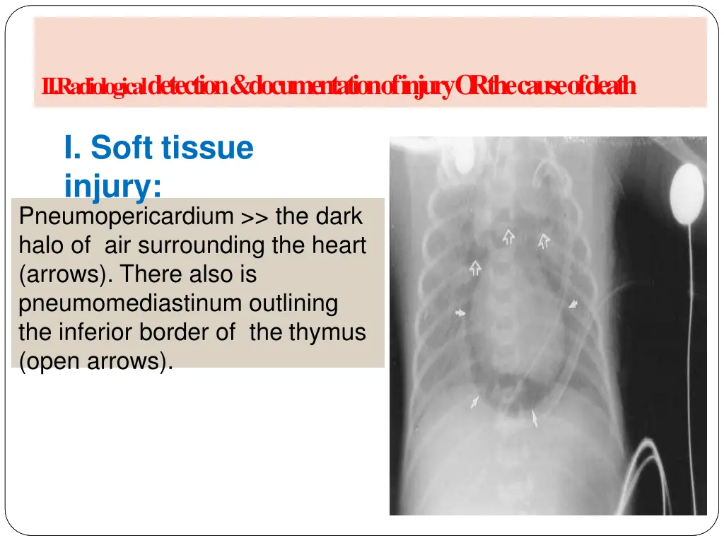 a radiology of injury ii radiological detection 4