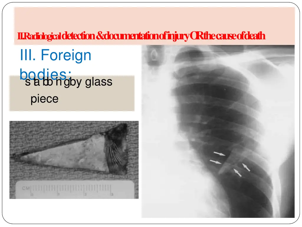 a radiology of injury ii radiological detection 5