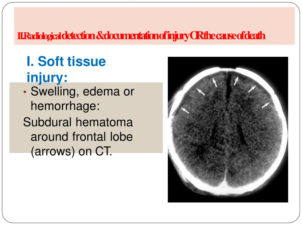 a radiology of injury ii radiological detection