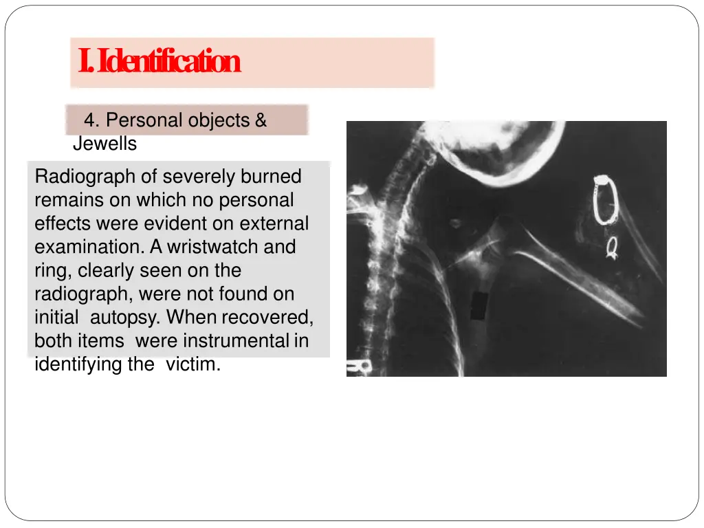 i identification 11