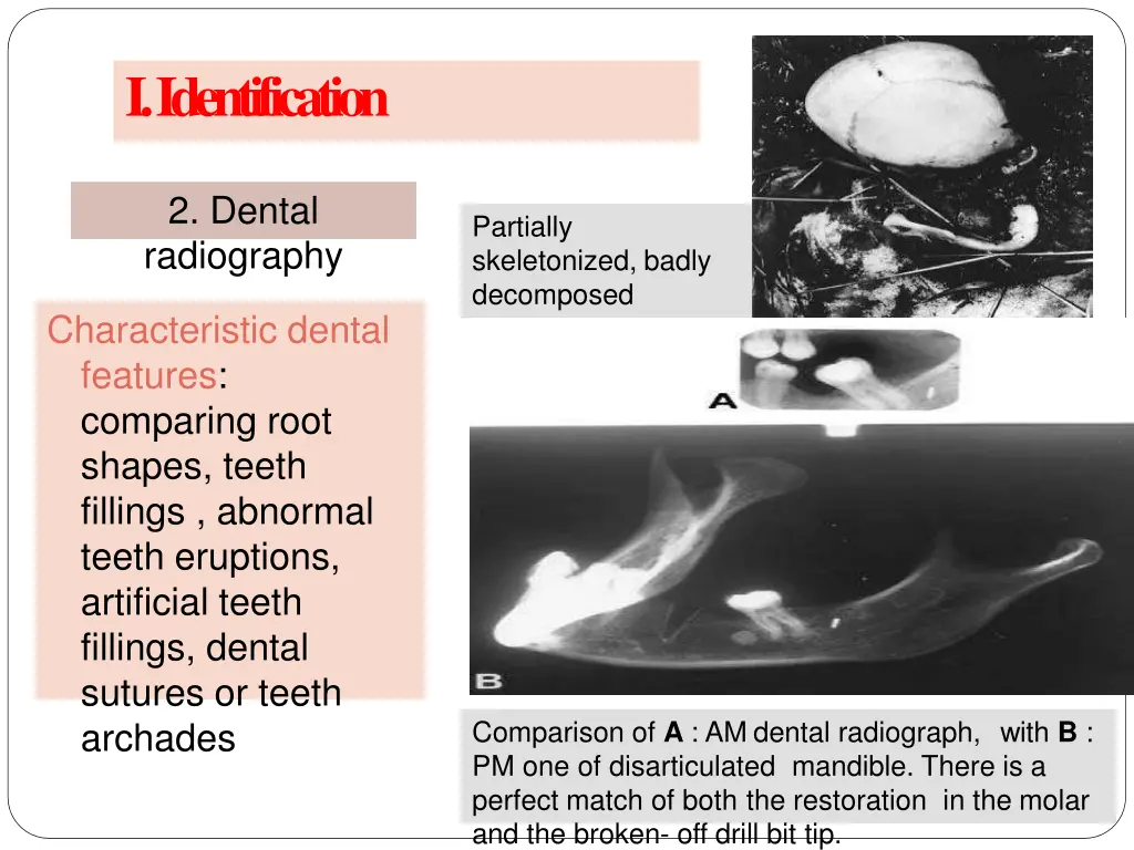 i identification 7