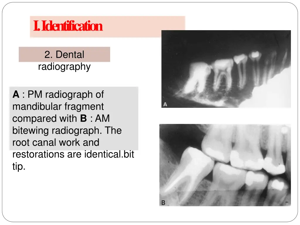 i identification 8