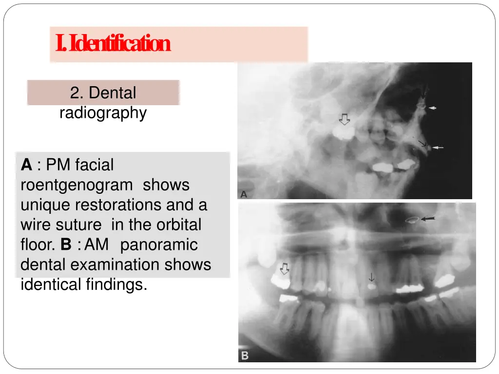 i identification 9