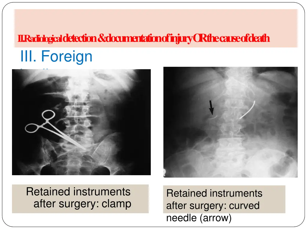 ii radiological detection documentation of injury 1