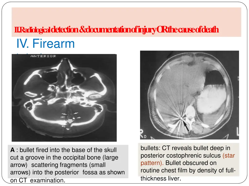 ii radiological detection documentation of injury 10