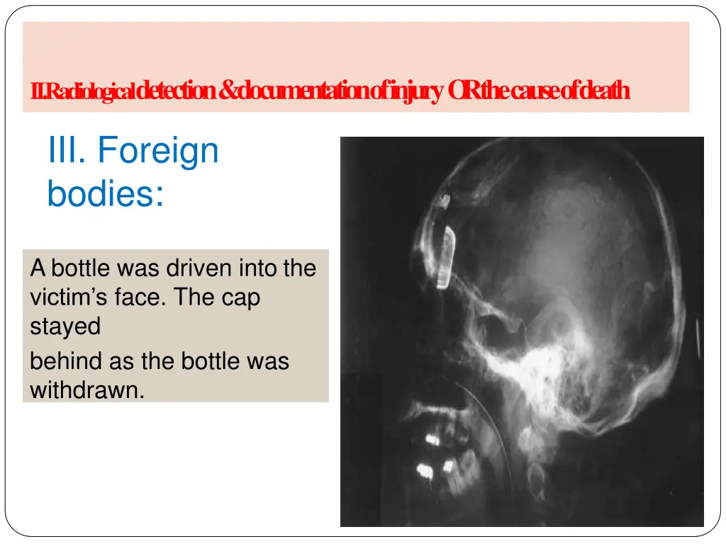 ii radiological detection documentation of injury 2