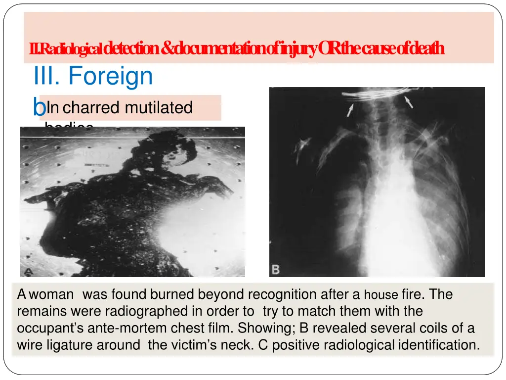 ii radiological detection documentation of injury 3