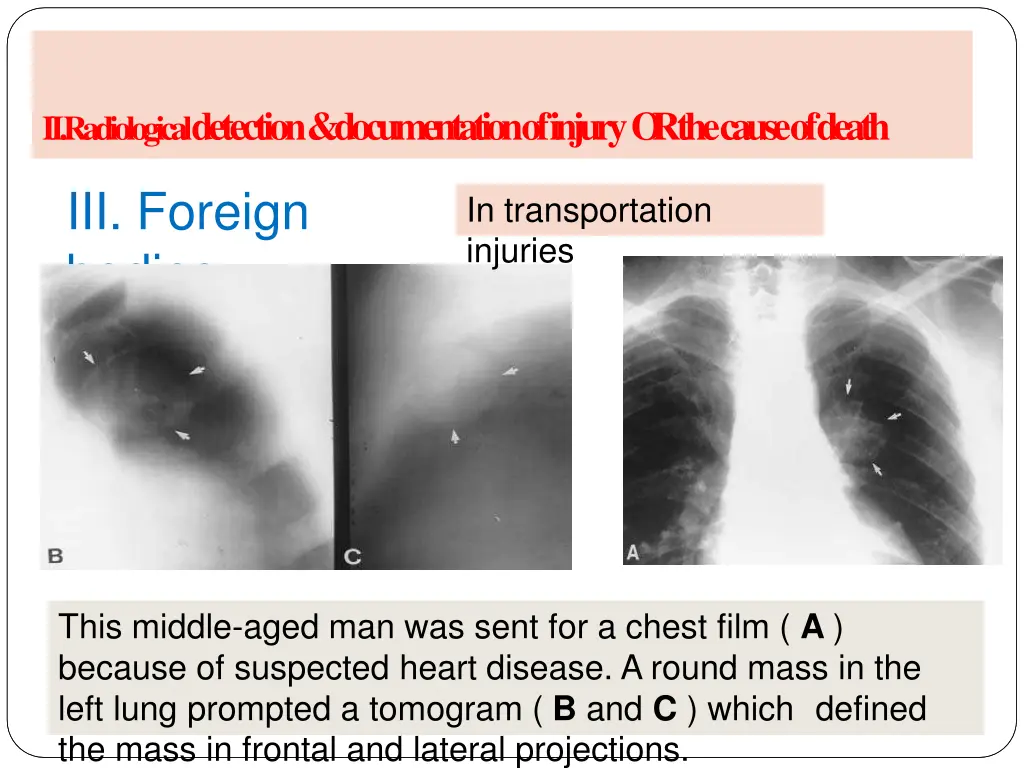 ii radiological detection documentation of injury 4