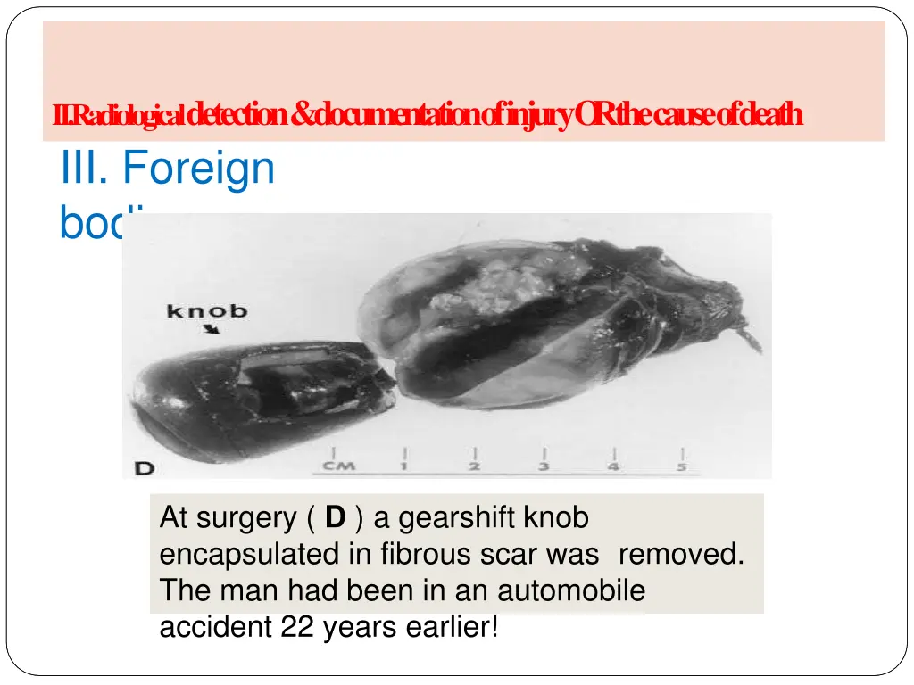 ii radiological detection documentation of injury 5