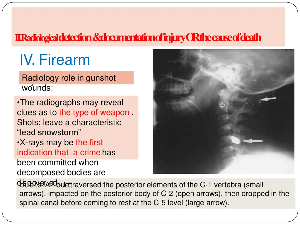 ii radiological detection documentation of injury 7