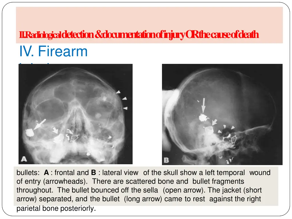 ii radiological detection documentation of injury 8